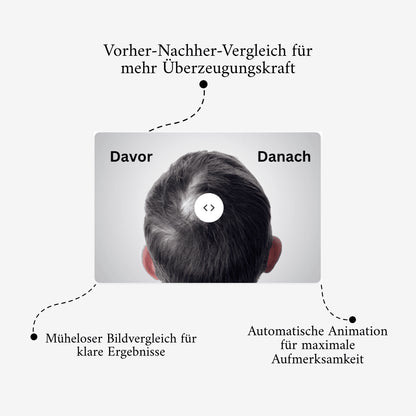 Vorher - Nachher Bildslider